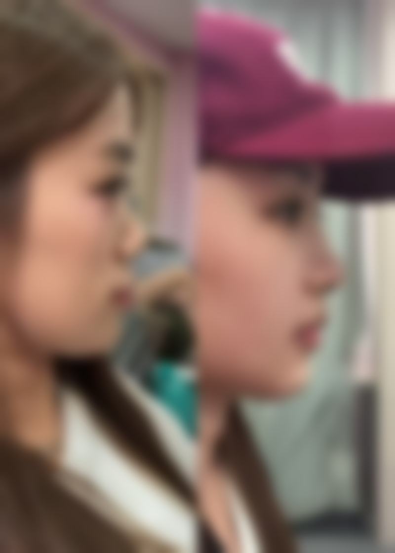 五、江苏施尔美整形美容医院实例