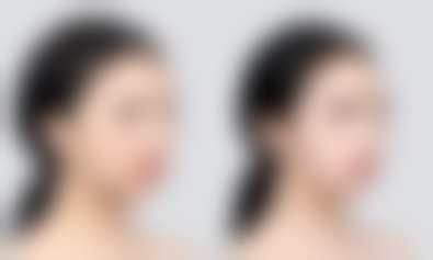 如何简单快速除眼袋？日常护理与物理辅助不可少