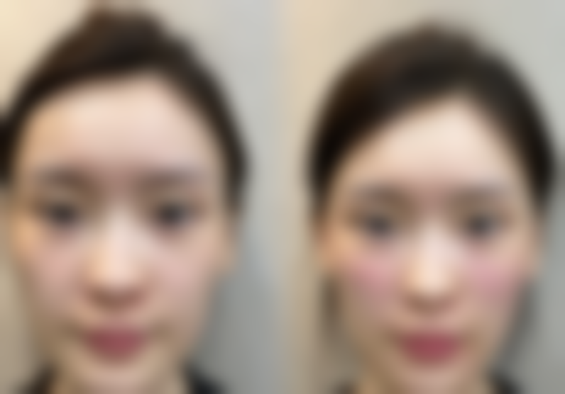 五、贵阳市第三人民医院整形美容科实例