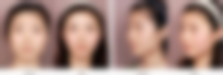 四、韩国首尔整形外科医院实例