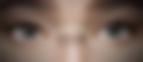 先天性眼袋究竟能否去除？非手术方式来帮忙