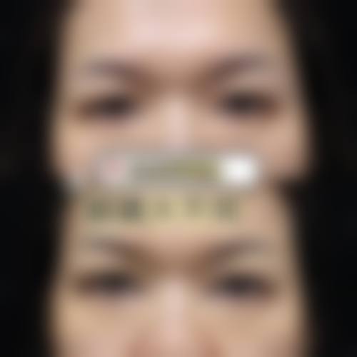 八、广西玉林悦目医疗美容真实的顾客评价如下：