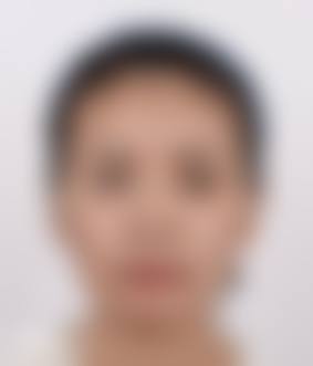 六、廊坊雅诗图整形医院怎么预约：