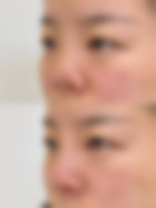 五、北京美泊医疗美容医院实例