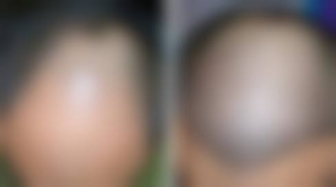 四、广西玉林悦目医疗美容开展的项目：