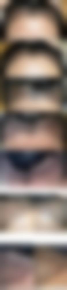 五、广西玉林悦目医疗美容实例