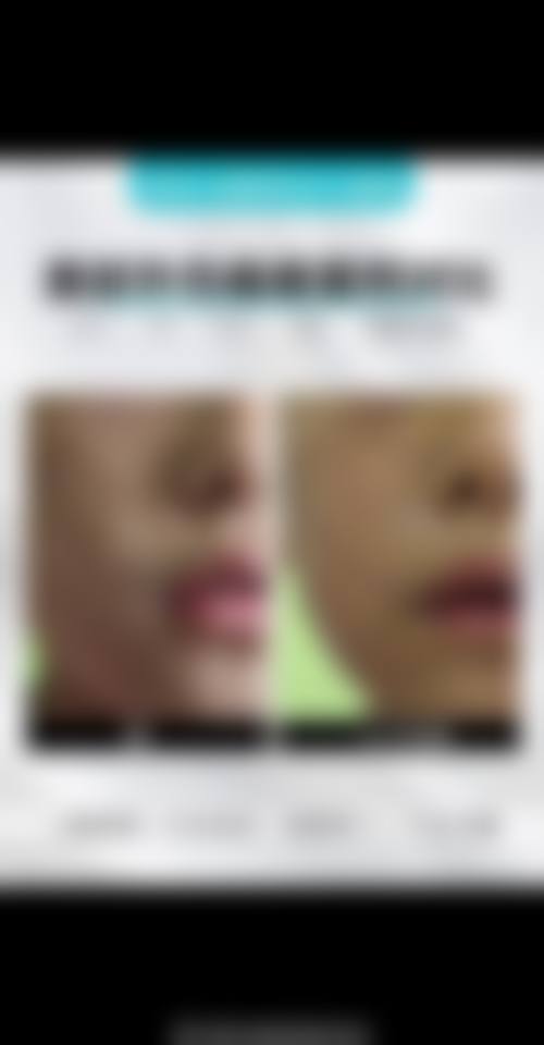 钱利医生在哪家医院怎么预约？