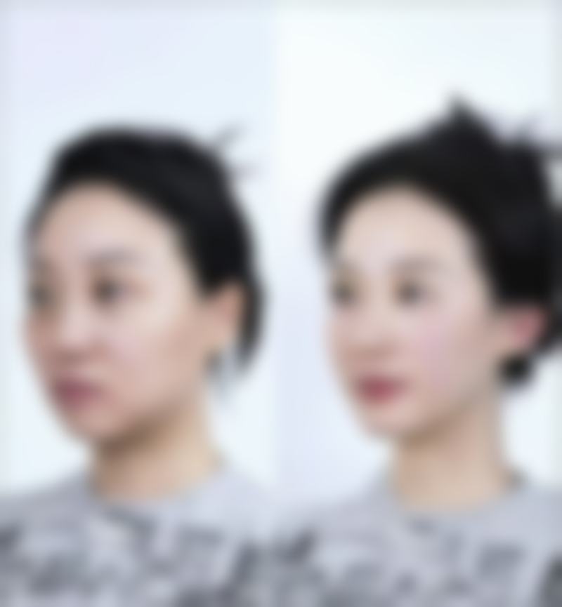 四、宜春菲斯医疗美容诊所实例