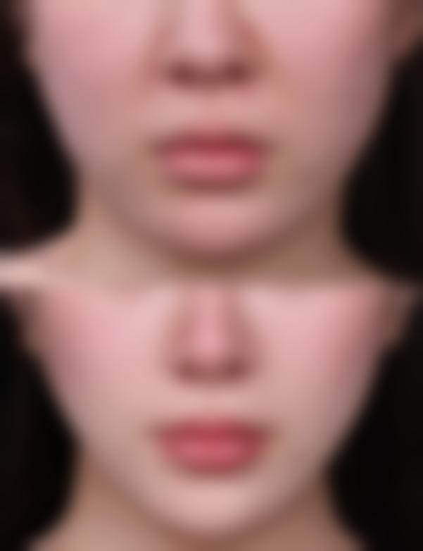 五、宜春菲斯医疗美容诊所怎么预约：