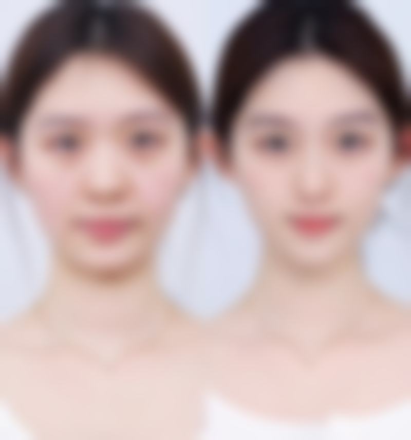 八、北京美泊医疗美容医院真实的顾客评价如下：