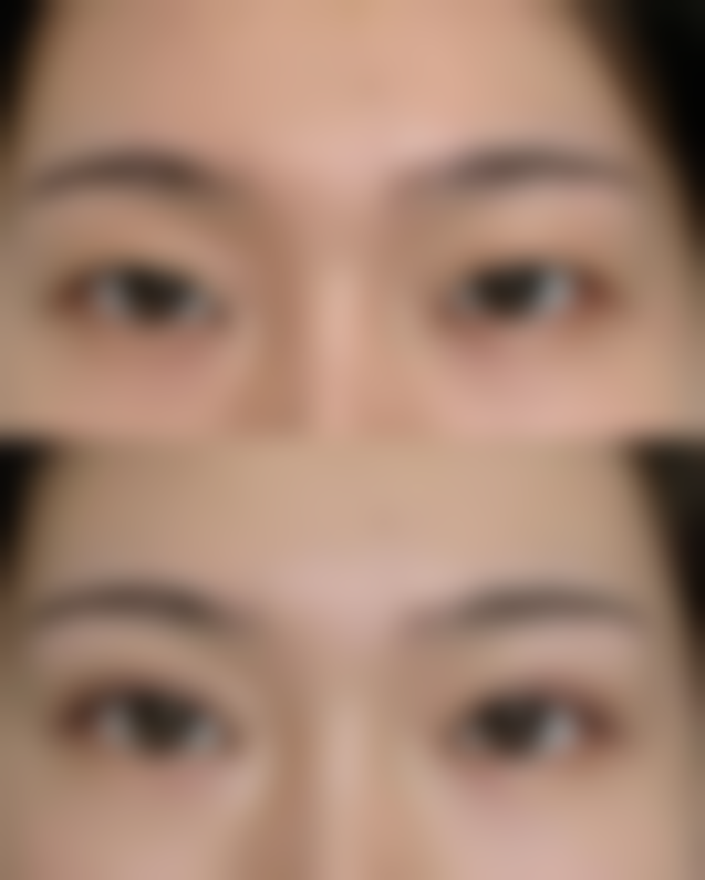 五、沈阳市博美美容整形中 心实例