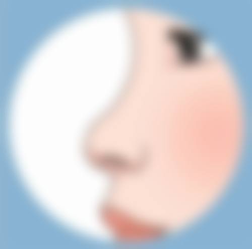 自体肋骨隆鼻优势大揭秘：材料安全持久，还能精准塑形打造自然美鼻！ 