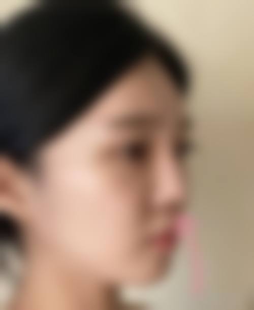 五、驻马店丽康医疗美容诊所实例