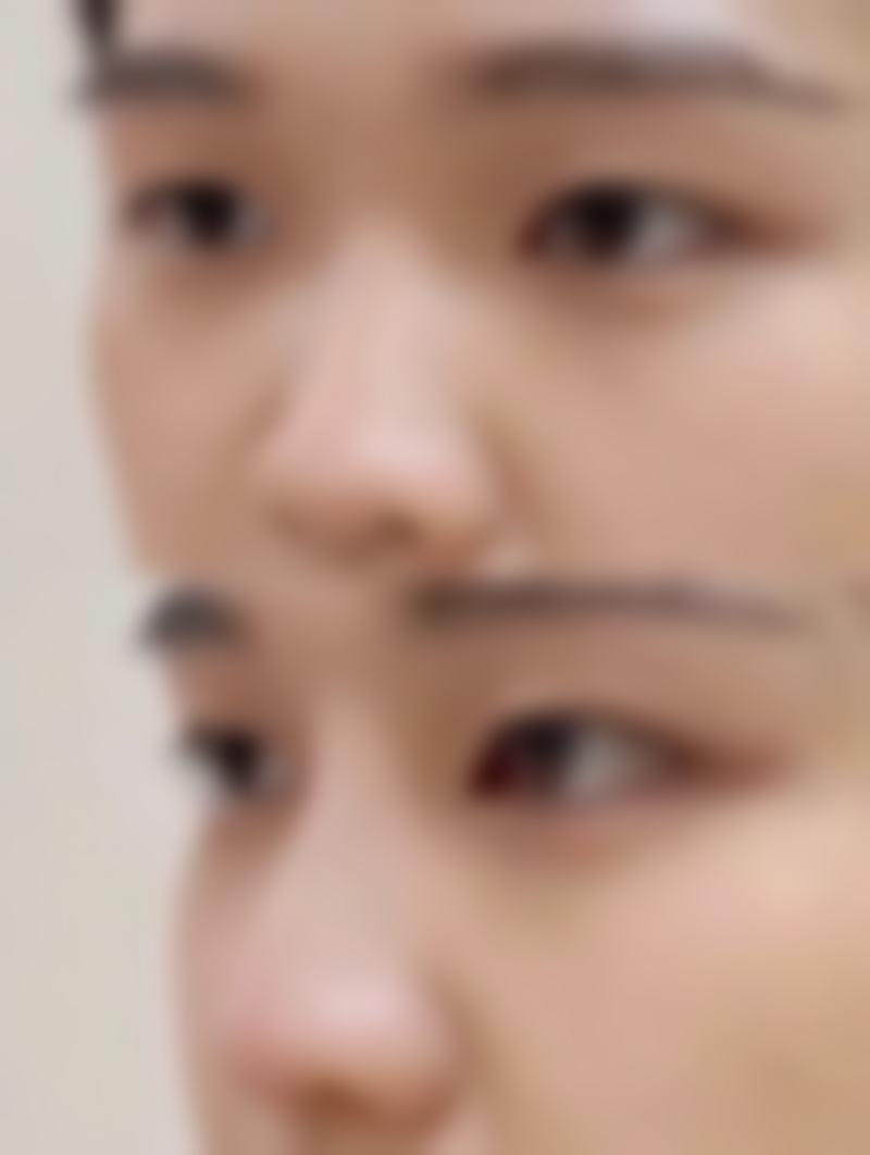 五、泰国三美泰素坤逸医院实例