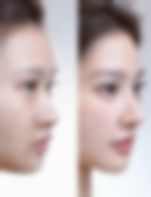 七、泰国三美泰素坤逸医院价格表：（仅供参考）