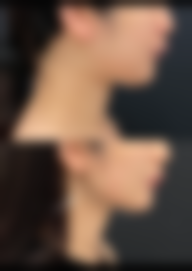 七、韩国伍人整形外科医院价格表：（仅供参考）