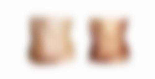 冰敷的注意事项：确保冰敷安心有效