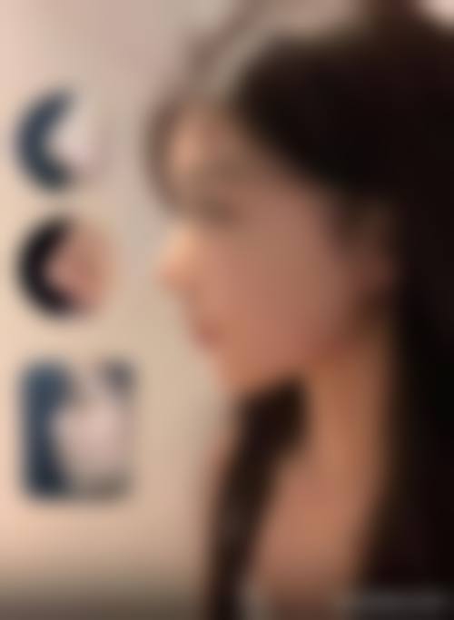 四、广安美枢佳颜整形医院实例