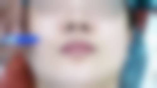 五、成都美著医疗美容诊所怎么预约：