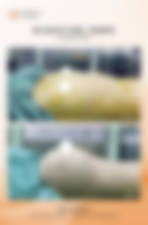 五、天津肿 瘤医院整形科实例