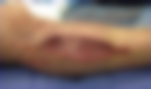 张胜昌医生在哪家医院怎么预约？