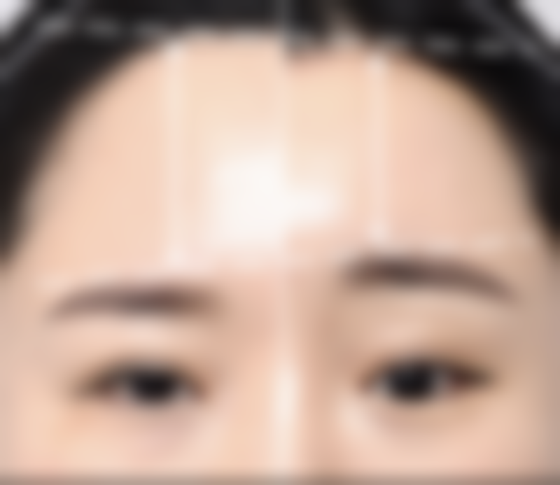 不同医生建议的冰敷频率差异及原因