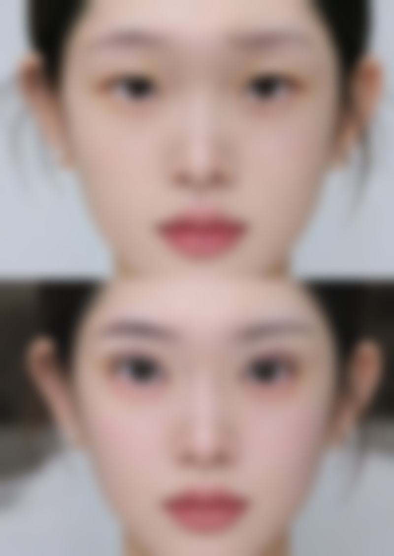 八、南京羲恩美致医疗美容诊所真实的顾客评价如下：