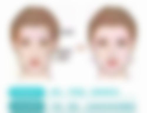 揭秘！生活习惯与眼部劳损——不良习惯催生眼袋细纹