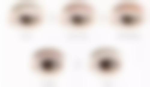 吸脂后何时开启射频紧肤？面部吸脂联合黄金微雕场景精细时间揭秘，促进愈合紧致肌肤增强成效