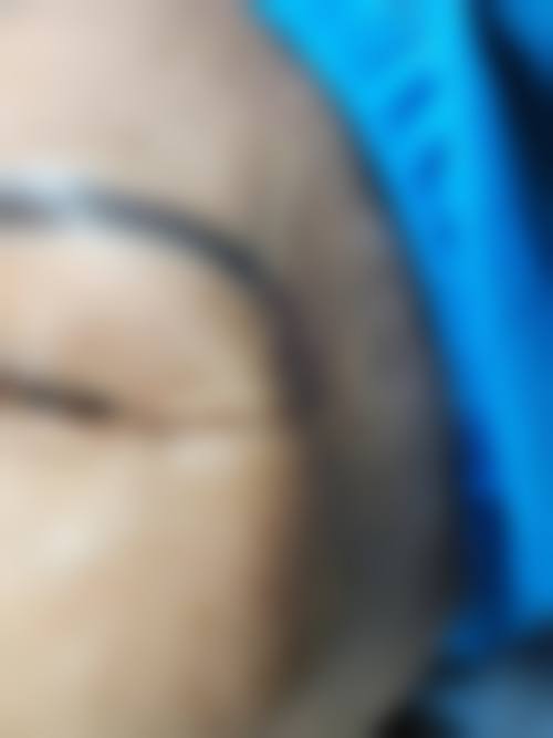 五、郑州可莱喜整形美容医院实例