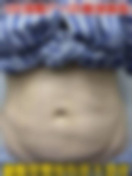 五、上海瑞佛（原爱尔丽）医疗美容诊所实例