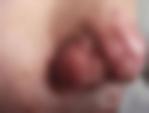 李嘉欣医生在哪家医院怎么预约？