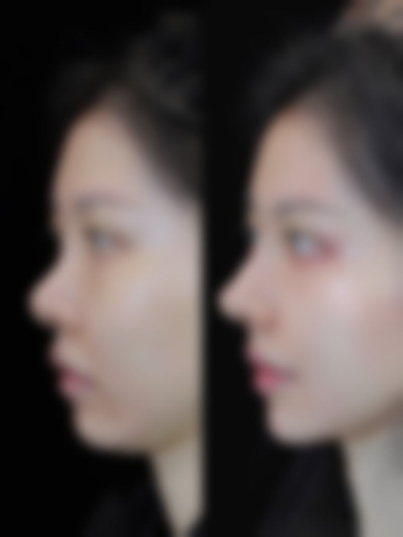 五、惠州鹏爱实例