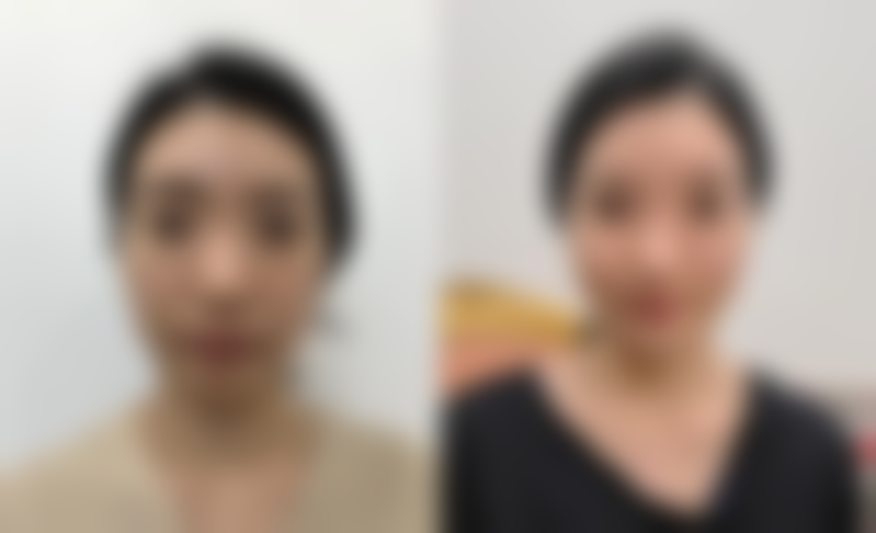 七、深圳港韩医疗整形医院价格表：（仅供参考）