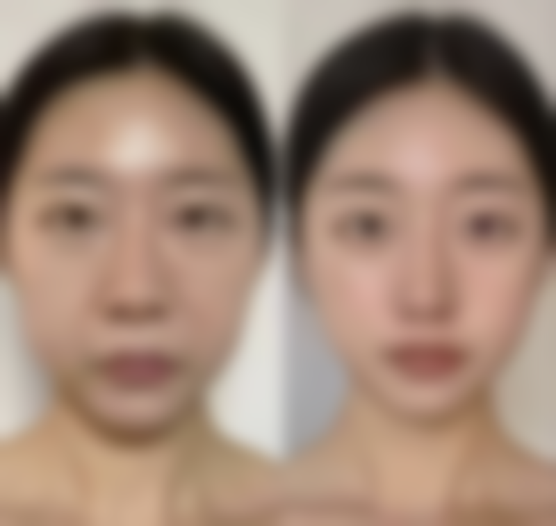 揭秘！紫外线照射——光老化加速眼袋纹路