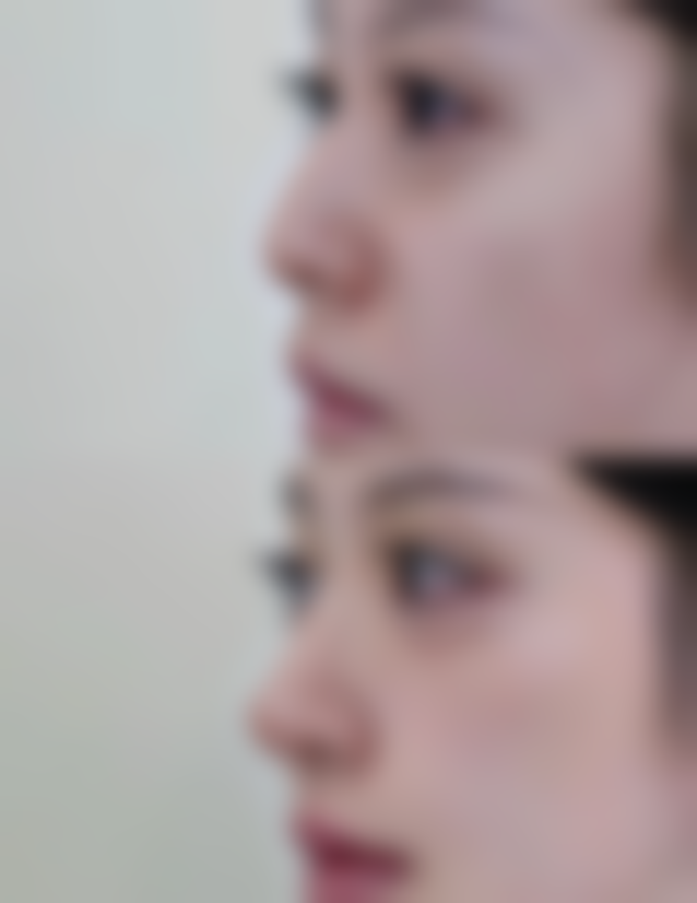 五、重庆徐铎丽格整形美容医院实例