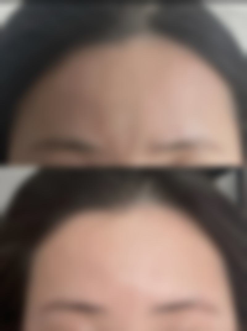 四、bellebeau皮肤科实例