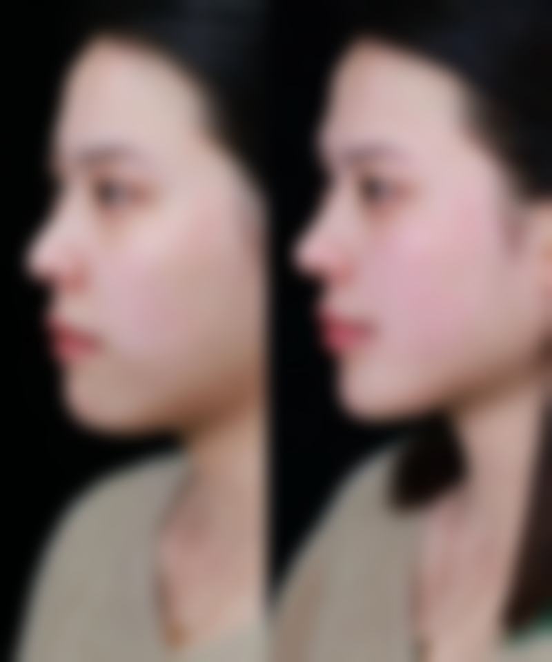 六、西昌玥美医疗美容整形诊所怎么预约：