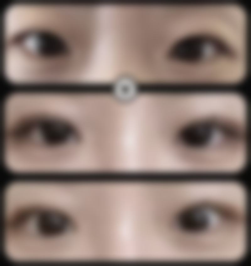 五、杭州禧美医疗美容医院实例