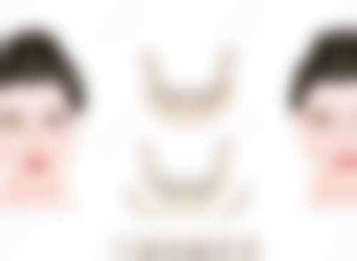 哪些脸型适合打瘦脸针？长脸打瘦脸针调整脸部比例