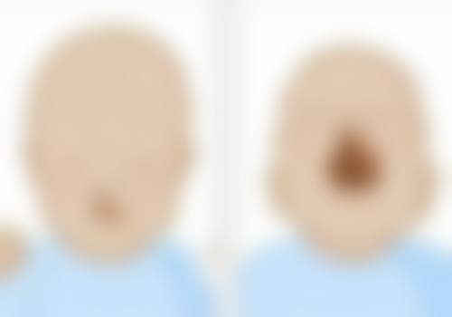 贺激光医生口碑和评价