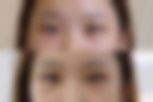 五、重庆高维英整形医院实例