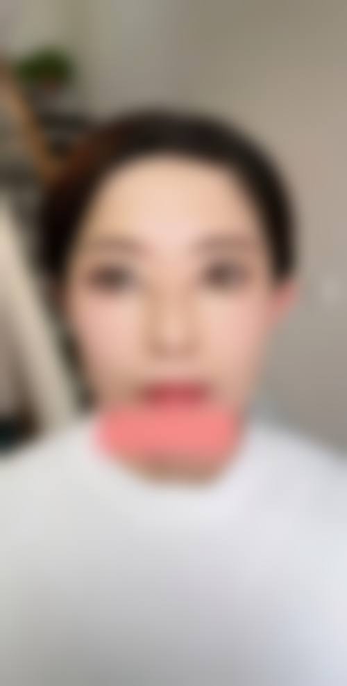 八、重庆高维英整形医院真实的顾客评价如下：