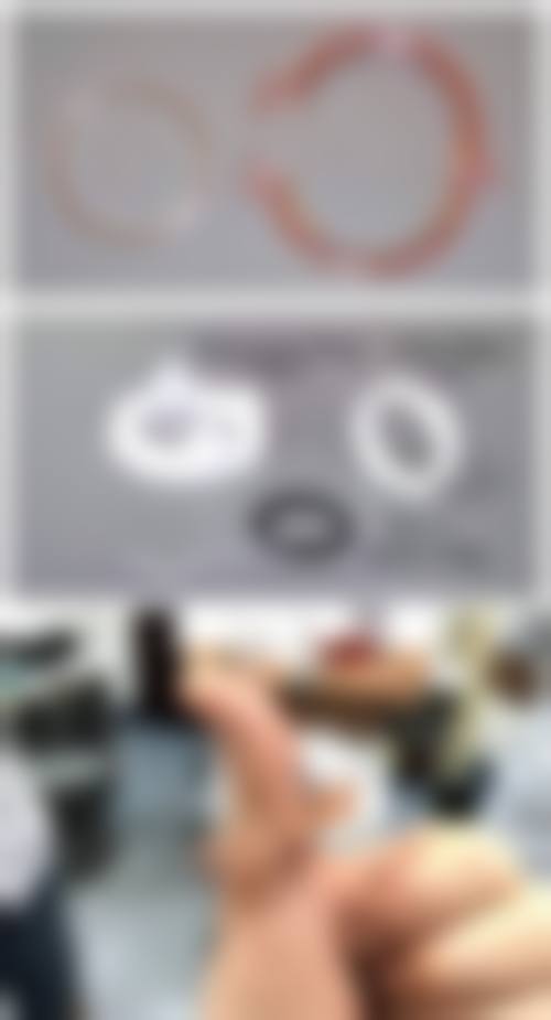 五、烟台康爱韩式整形美容医院实例