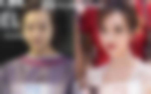 韩国珠儿丽Jewelry整形医院