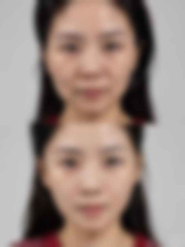 六、呼和浩特周红玲医疗美容诊所怎么预约：