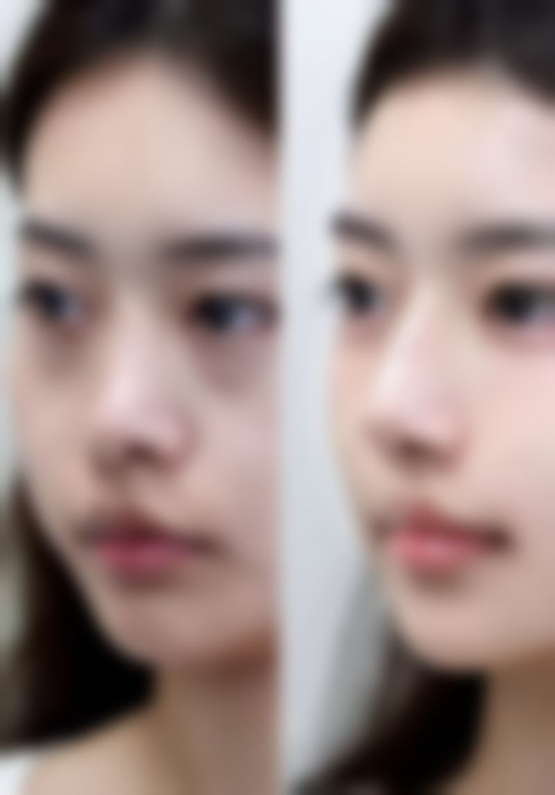 八、呼和浩特周红玲医疗美容诊所真实的顾客评价如下：