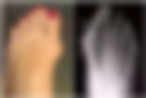 手术隆胸究竟是怎样操作的？手术时长与优势展现