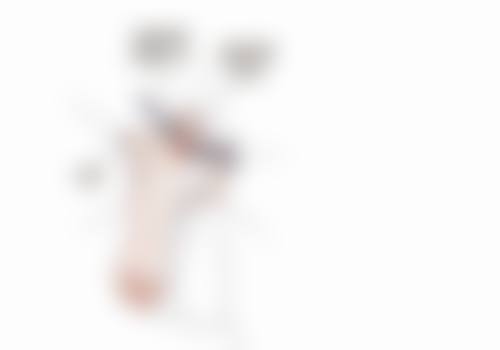 全切双眼皮第八天拆线会怎样？正常范围无不良影响，还能规避过早拆线风险