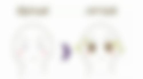 手术隆胸究竟是怎样操作的？总结与展望